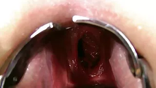 ফ্রিস্কি এবং শৃঙ্গাক ...
